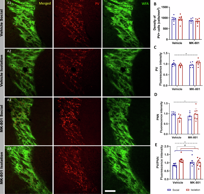 Fig. 3: Analysis of parvalbumin expressing (PV+) neurons and perineuronal nets (PNN) in the thalamic reticular nucleus (TRN).