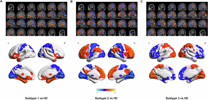 Dissecting biological heterogeneity in major depressive disorder based on neuroimaging subtypes with multi-omics data