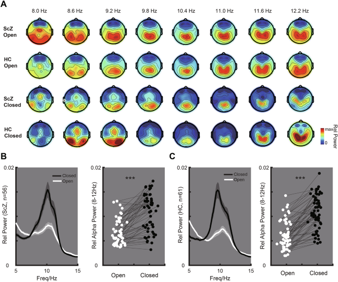 Fig. 1: Comparison of Power Across Multiple Alpha Bands Between Closed-Eye and Open-Eye States.