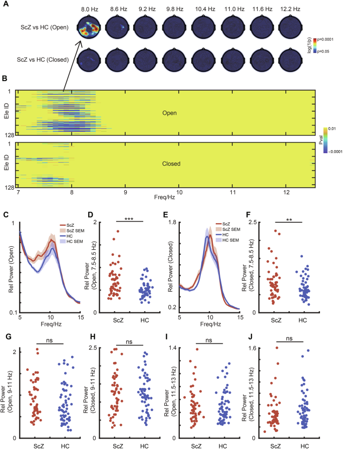 Fig. 2: Comparison of Power Across Multiple Alpha Bands Between Schizophrenia and Healthy Control Groups.