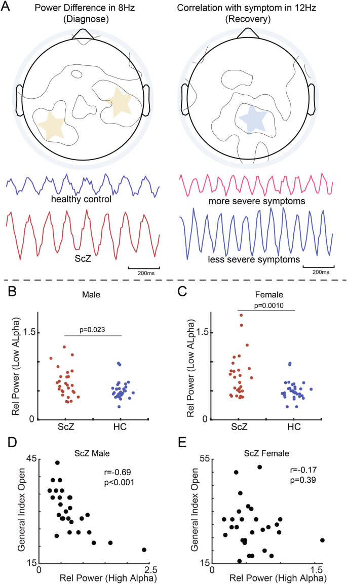 Fig. 4: A schematic illustration of our main findings regarding the properties of low and high alpha rhythms and their gender bias.