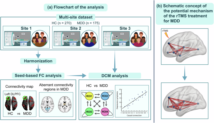 Fig. 1: Flowchart of the study protocol and schematic concept of the potential mechanism of the rTMS treatment for MDD.