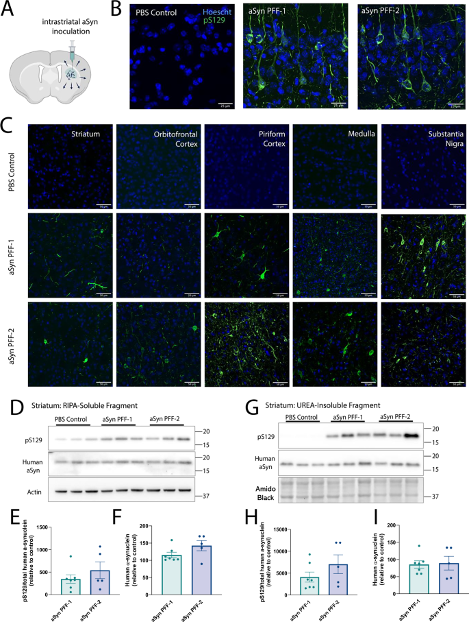 Fig. 3: Propagation of aggregated α-synuclein following inoculation of pre-formed fibrils in vivo.