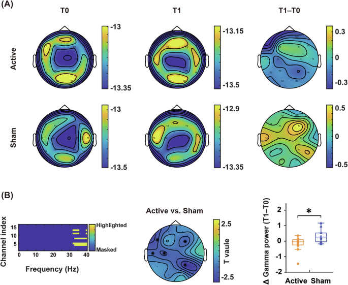 Fig. 3: Gamma-band (32–40 Hz) spectral power analysis.