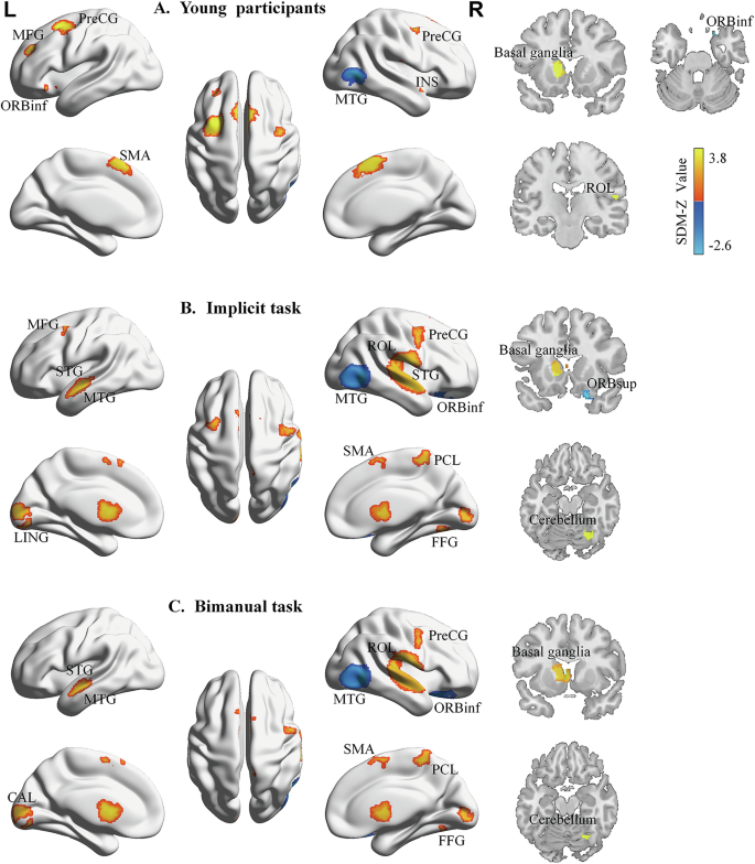 Fig. 3: Results of subgroup analyses showing brain activation associated with the contrast between sequential and random conditions.