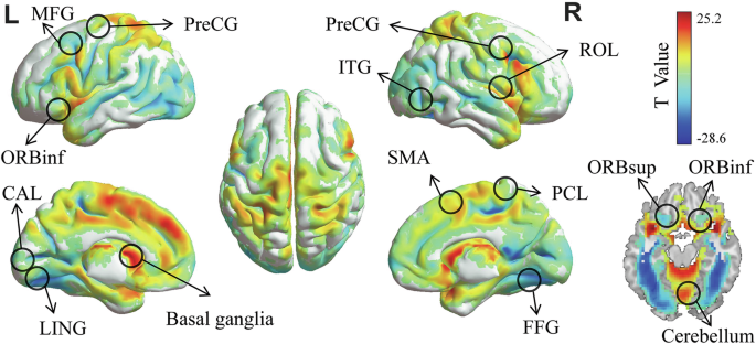 Fig. 4: The results of validating dataset comparing sequential and random conditions related brain activation.