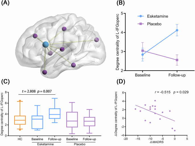 Fig. 2: Brain functional network change and its association with improvement in depressive symptoms following esketamine administration.