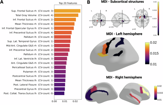 Fig. 1: Key Brain Regions Contributing to the Classification of SSD vs. HC based on normative deviations.