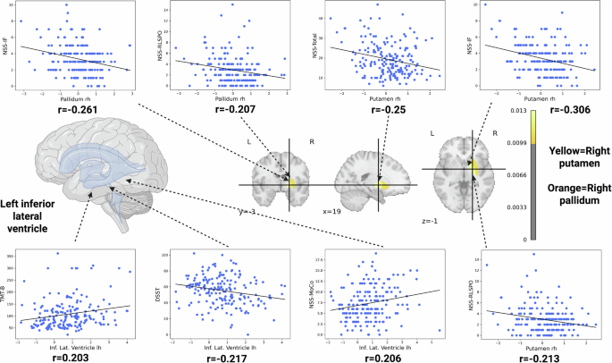 Fig. 3: Associations of right pallidum and putamen and left inferior lateral ventricle morphology with cognitive and sensorimotor measures.