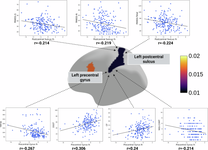 Fig. 4: Associations of left postcentral and left pericallosal sulcal morphology with psychopathological, cognitive and sensorimotor measures.