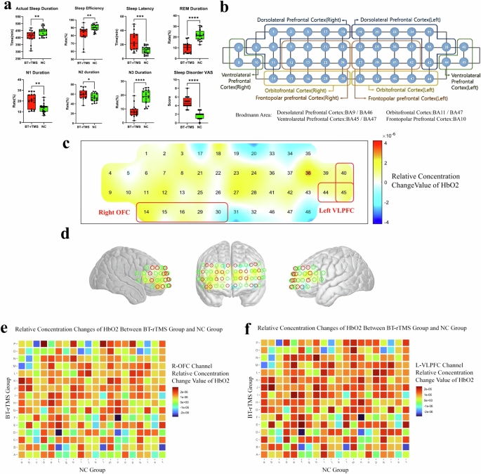 Fig. 8: Analysis of differences in observational data between the BT-rTMS group and the NC group.