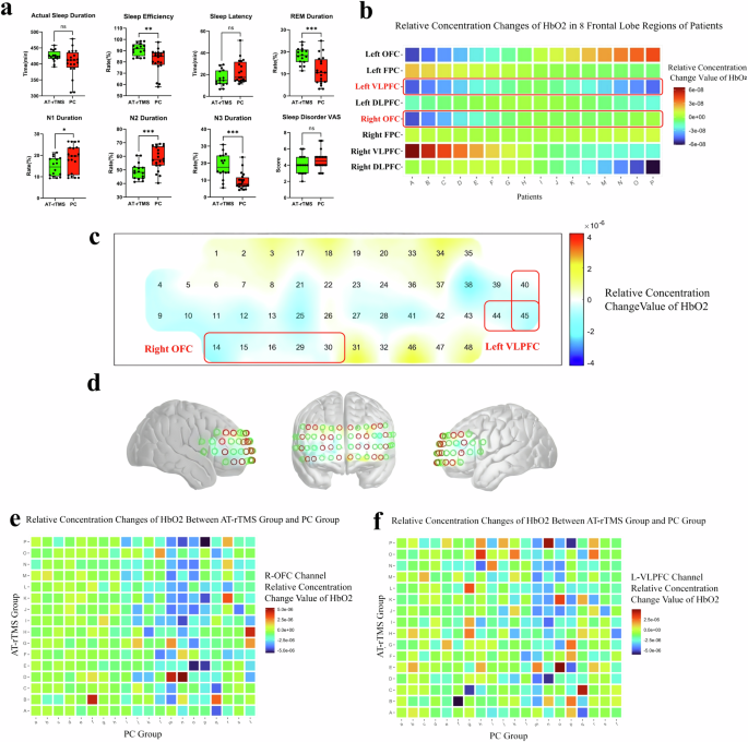 Fig. 9: Analysis of differences in observational data between the AT-rTMS group and the PC group.