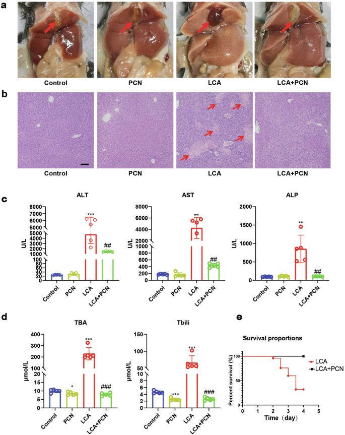 Activation of pregnane X receptor protects against cholestatic 