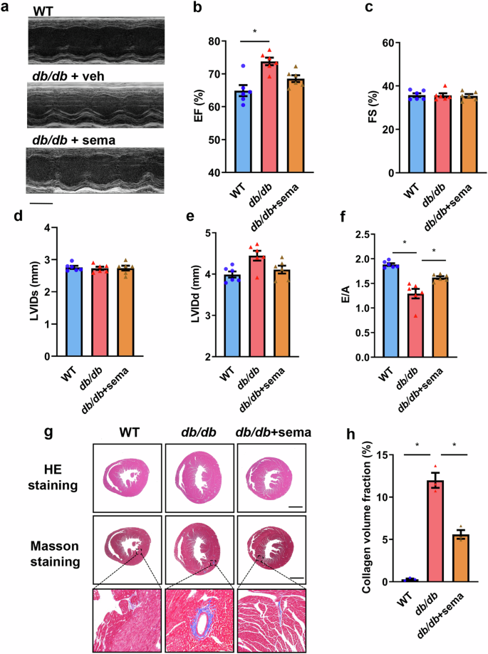 Semaglutide administration protects cardiomyocytes in db/db mice via energetic improvement and mitochondrial quality control | Acta Pharmacologica Sinica Semaglutide administration protects cardiomyocytes in db/db mice via energetic improvement and mitochondrial quality control | Acta Pharmacologica Sinica