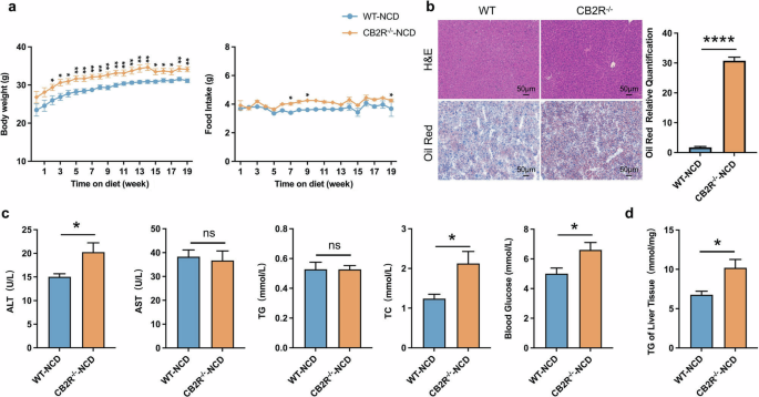 Fig. 2: The CB2R–/– mice with NCD developed NAFLD.