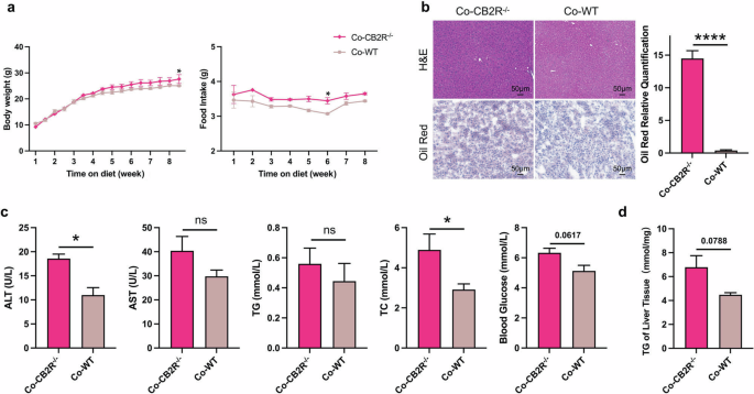 Fig. 3: The severity of NAFLD in CB2R–/– mice was improved when cohousing with WT mice.