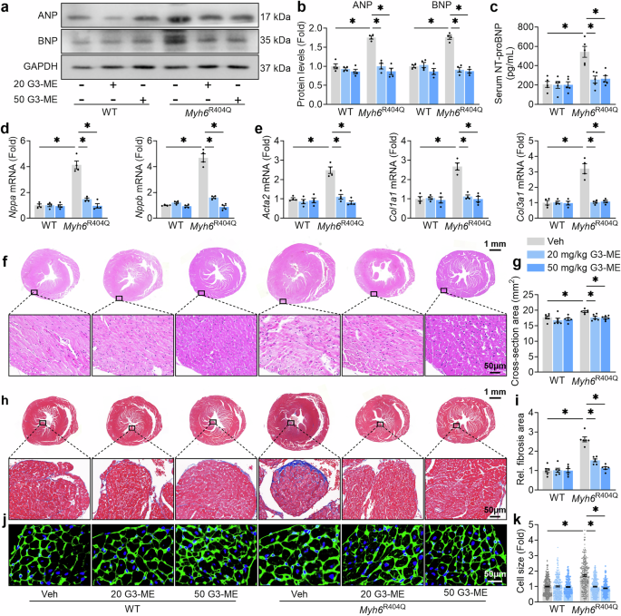 Fig. 4: Galangin 3-methyl ether (G3-ME) improves cardiac injury and remodeling in Myh6R404Q mice.