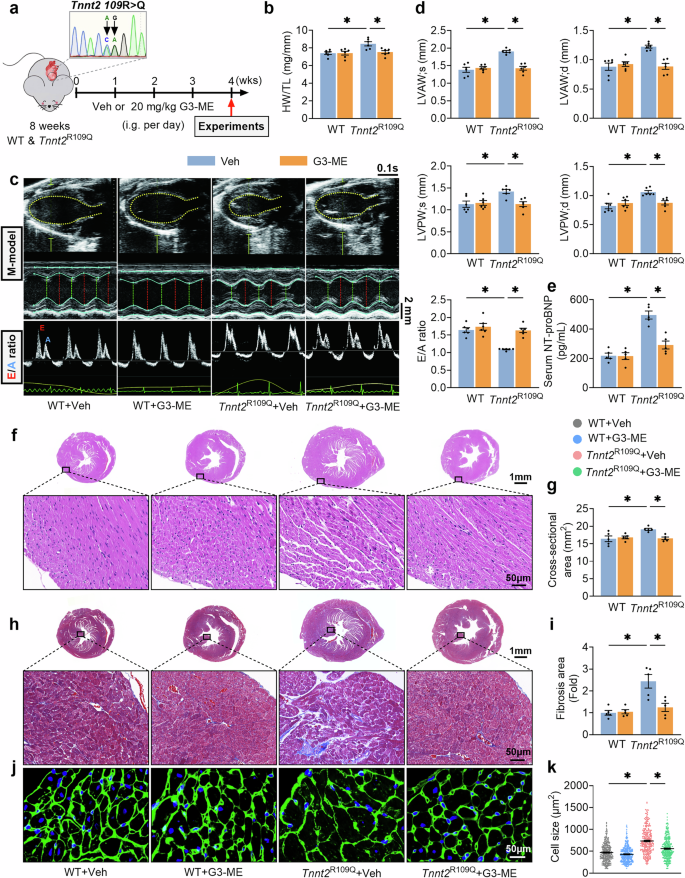 Fig. 5: Galangin 3-methyl ether (G3-ME) improves both cardiac function and structure in Tnnt2R109Q mice with pathological cardiac hypertrophy.