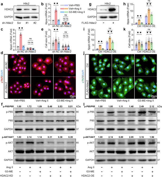 Fig. 8: Interference with HDAC2 expression influences the cardioprotective effect of galangin 3-methyl ether (G3-ME) on PI3K-AKT signaling and cardiac hypertrophy.