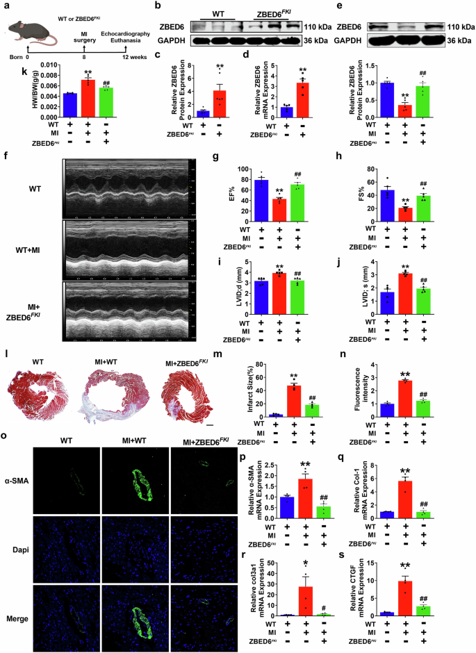 Fig. 2: ZBED6 transgenic overexpression reverses cardiac fibrosis induced by MI in mice.
