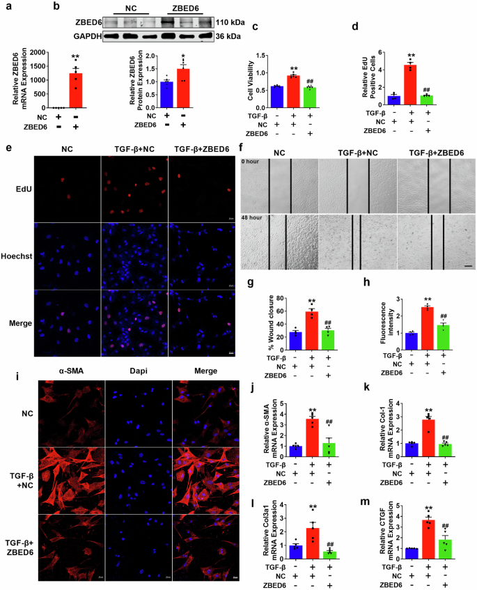 Fig. 4: ZBED6 overexpression prevents PMCFs activation induced by TGF-β in vitro.