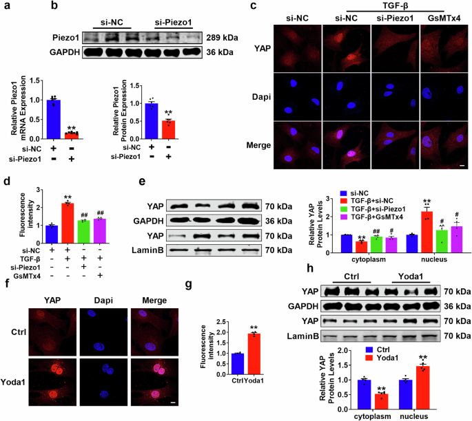 Fig. 8: Piezo1 facilitates YAP translocation to the nucleus.