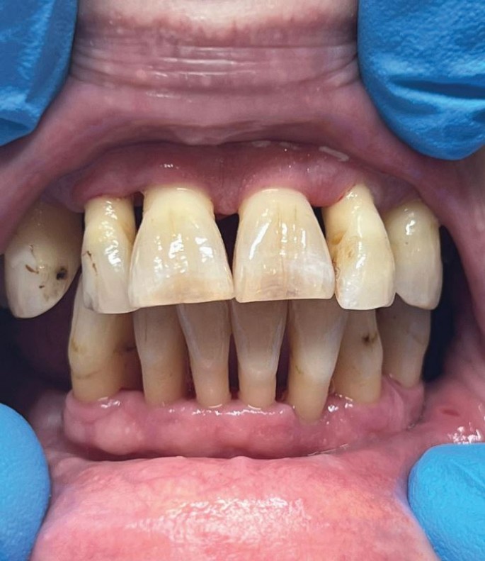 Lifestyle Medicine In Periodontal Practice The Whys Wherefores And lifestyle-medicine-in-periodontal-practice-the-whys-wherefores-and