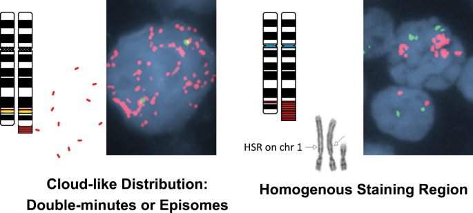 Fig. 2: Representative images illustrating the two main patterns of MYC amplification.