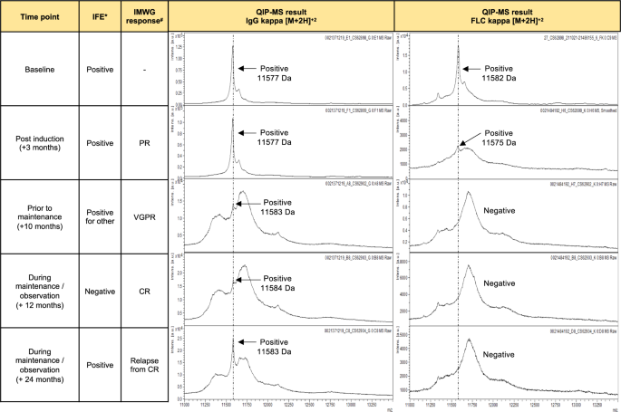 Fig. 1: Example on longitudinal response monitoring using QIP-MS and immunofixation.