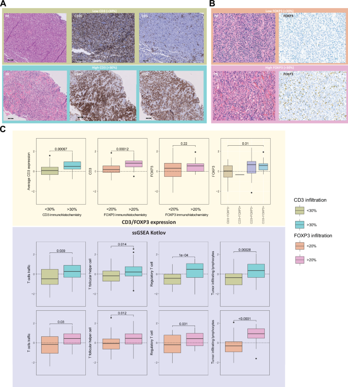 Fig. 6: Correlation of the CD3 immunohistochemistry for T-cell infiltration with gene expression data.