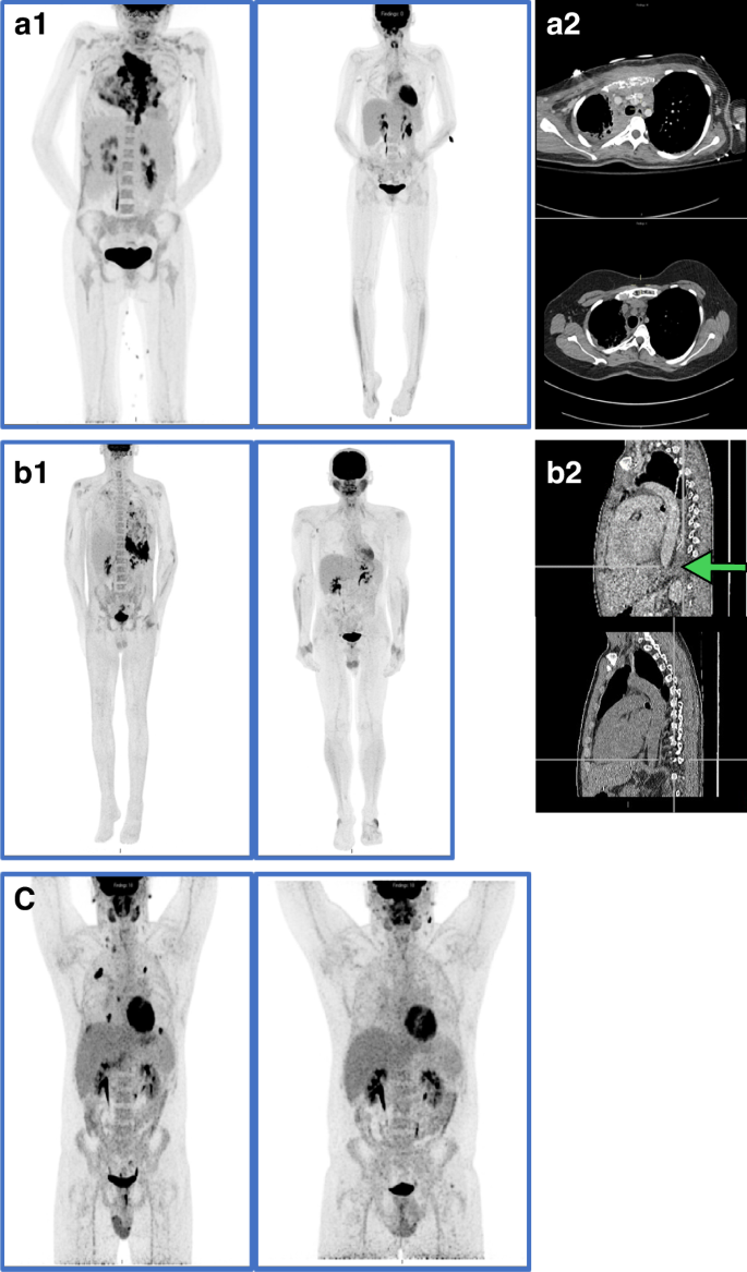 Fig. 1: Representative radiology (left to right).