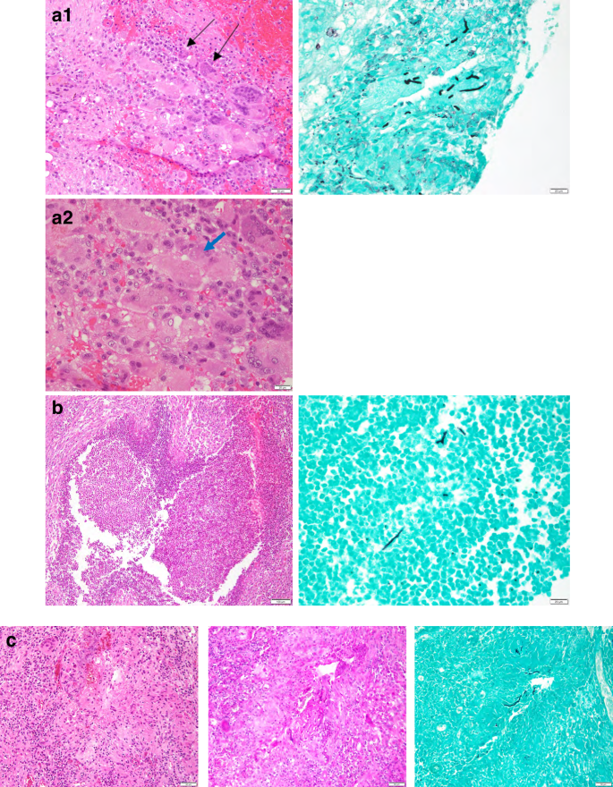 Fig. 2: Representative pathology imaging from 3 patients.