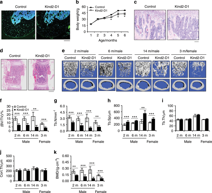 Focal Adhesion Protein Kindlin 2 Regulates Bone Homeostasis In Mice Bone Research