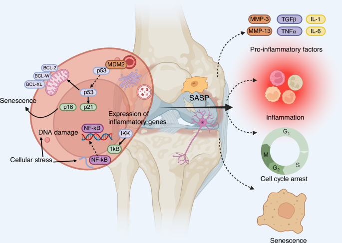Novel therapeutic strategies for osteoarthritis: from mechanistic insights to precision medicine