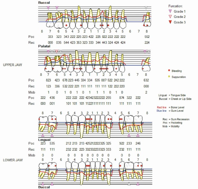 Periodontal Screening And Recording Chart