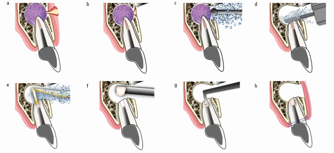 figure 24