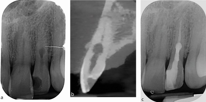 figure 14