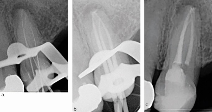 figure 16