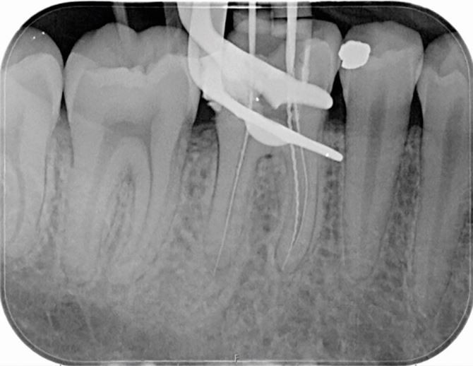 figure 17
