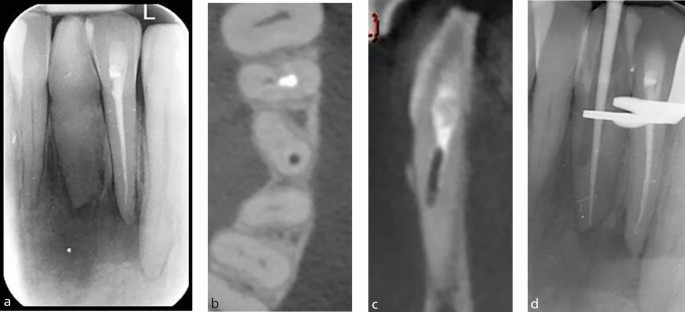 figure 18