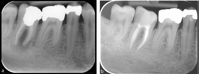 figure 22