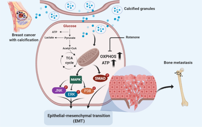 metastatic cancer glucose