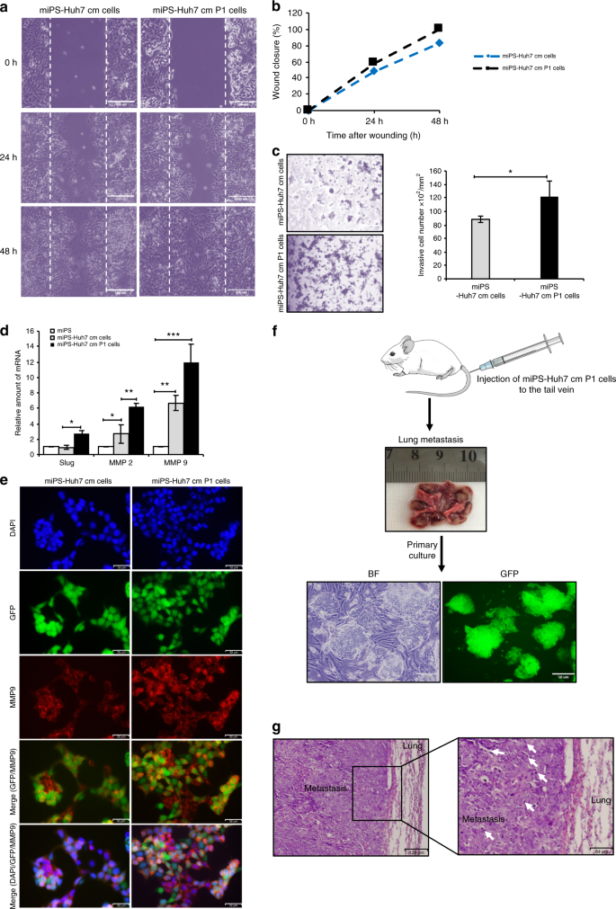A Novel Model Of Liver Cancer Stem Cells Developed From Induced Images, Photos, Reviews