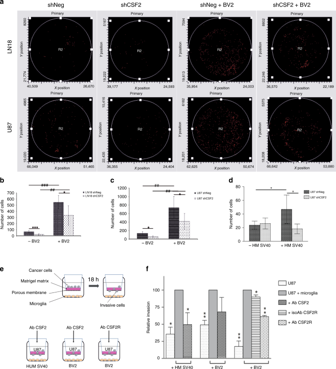 Fig. 3: CSF2 knockdown reduces microglia-dependent invasion of human glioblastoma cells.
