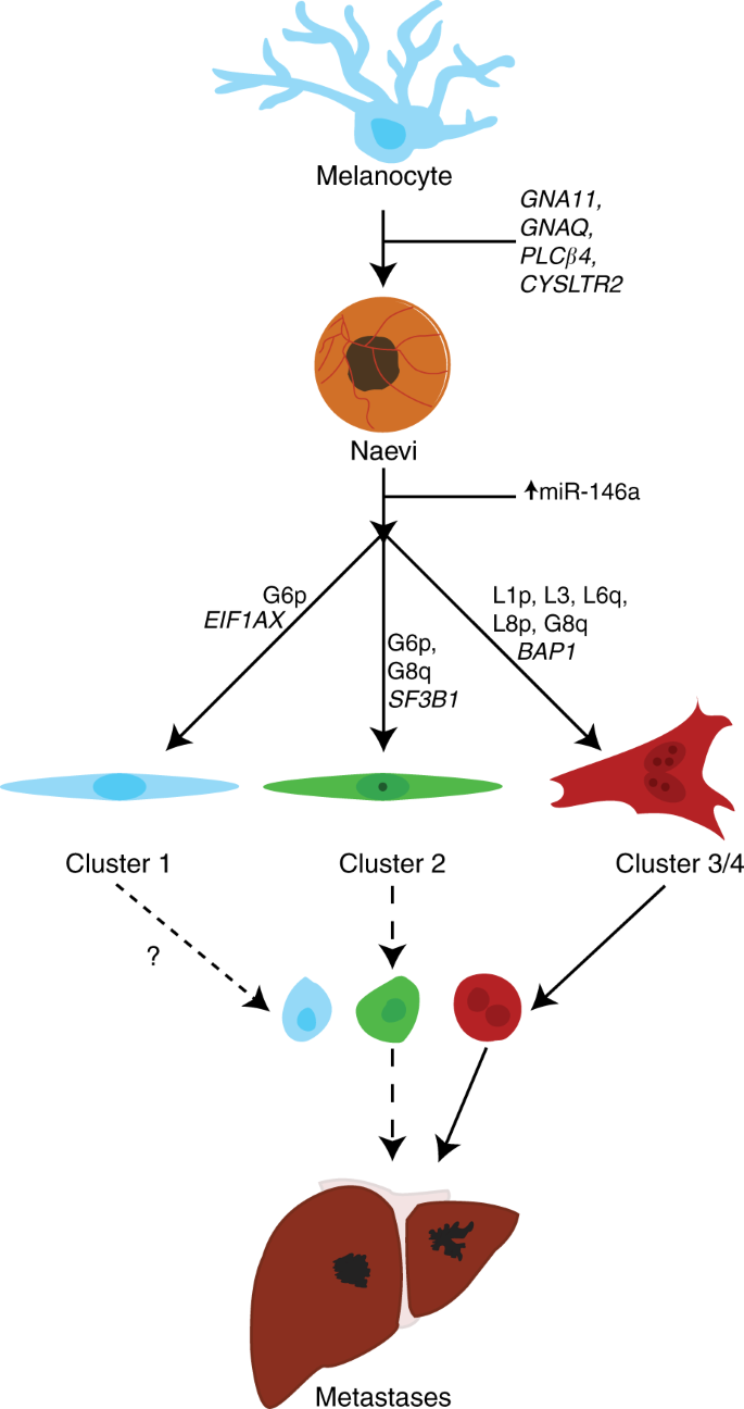 Fig. 2: Genetic pathways of uveal melanoma progression.