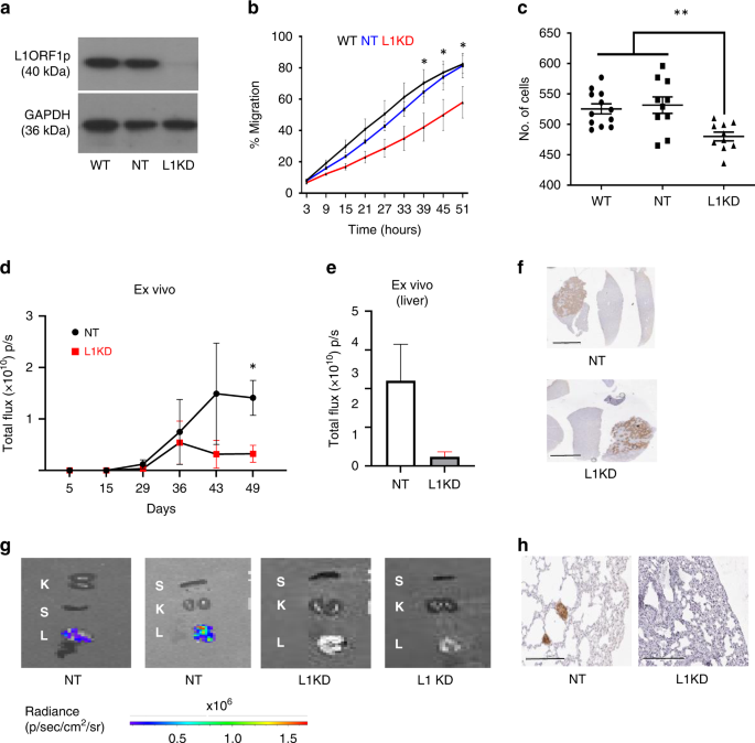 Fig. 3: Influence of L1 knockdown on Huh7 cells.