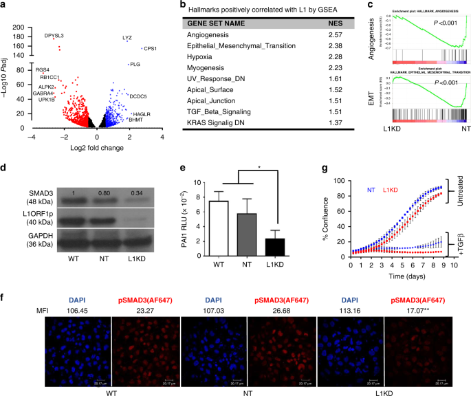 Fig. 4: Influence of L1 knockdown on signalling pathways in Huh7 cells.