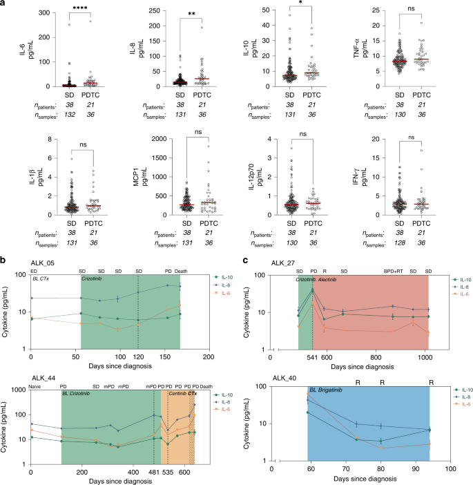 Fig. 2: IL-6, IL-8 and IL-10 serum levels are elevated at disease progression.