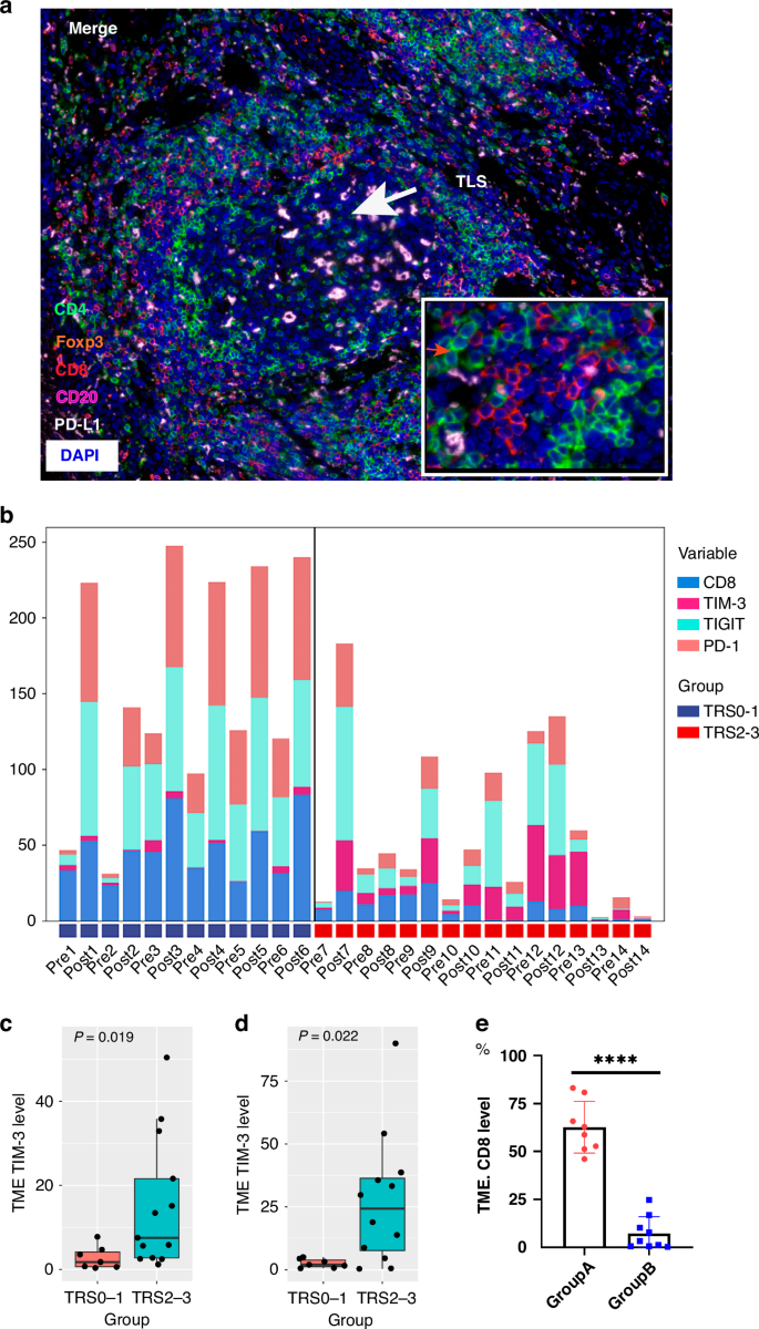 Fig. 5: TLSs, TIM-3/TIGIT/PD-1 expression and TRS in tumour specimen before and after nICT.