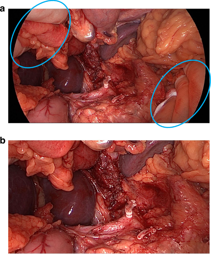 Fig. 1: Image anonymisation using ‘cropping’.
